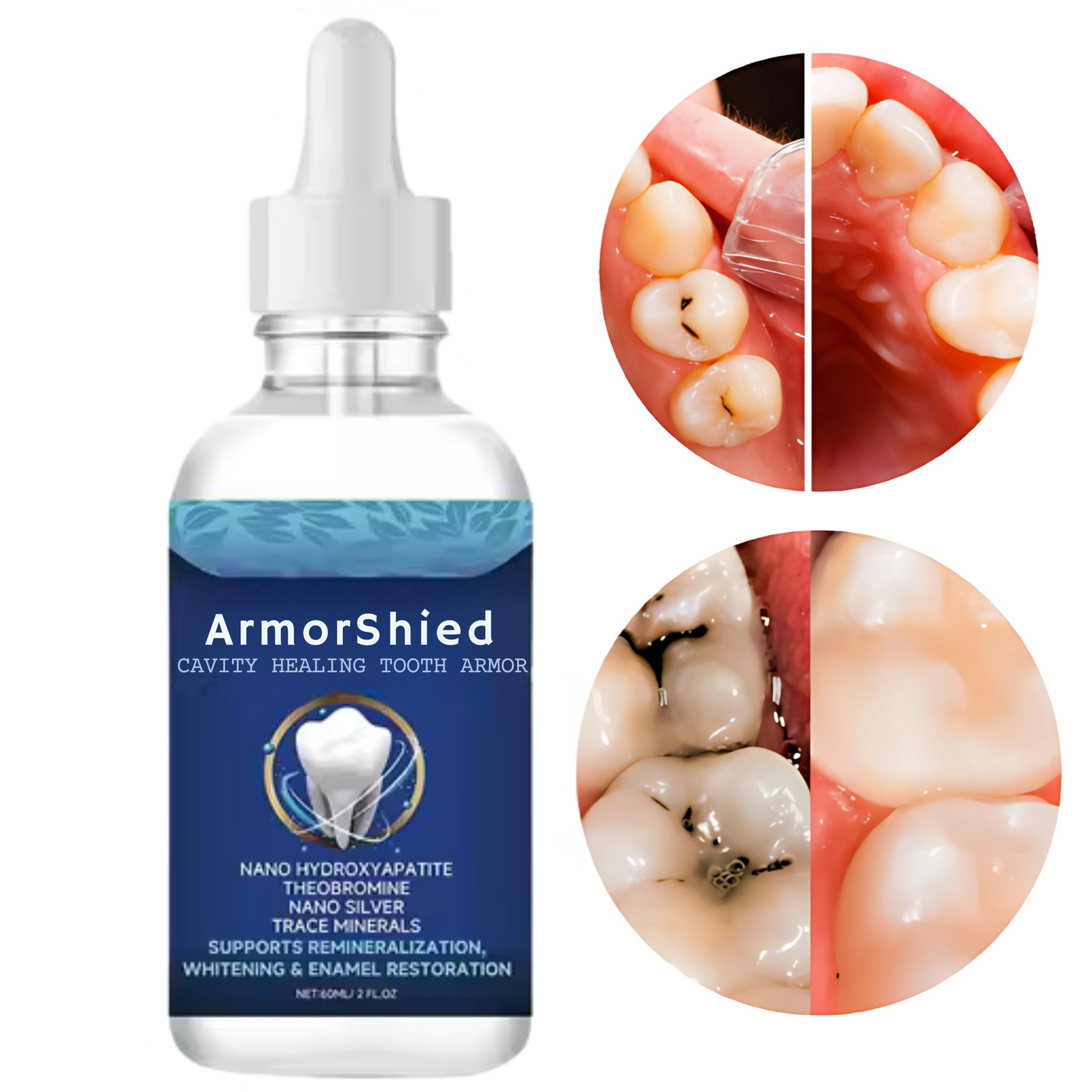 ArmorShied Tooth Armor Liquid Drops