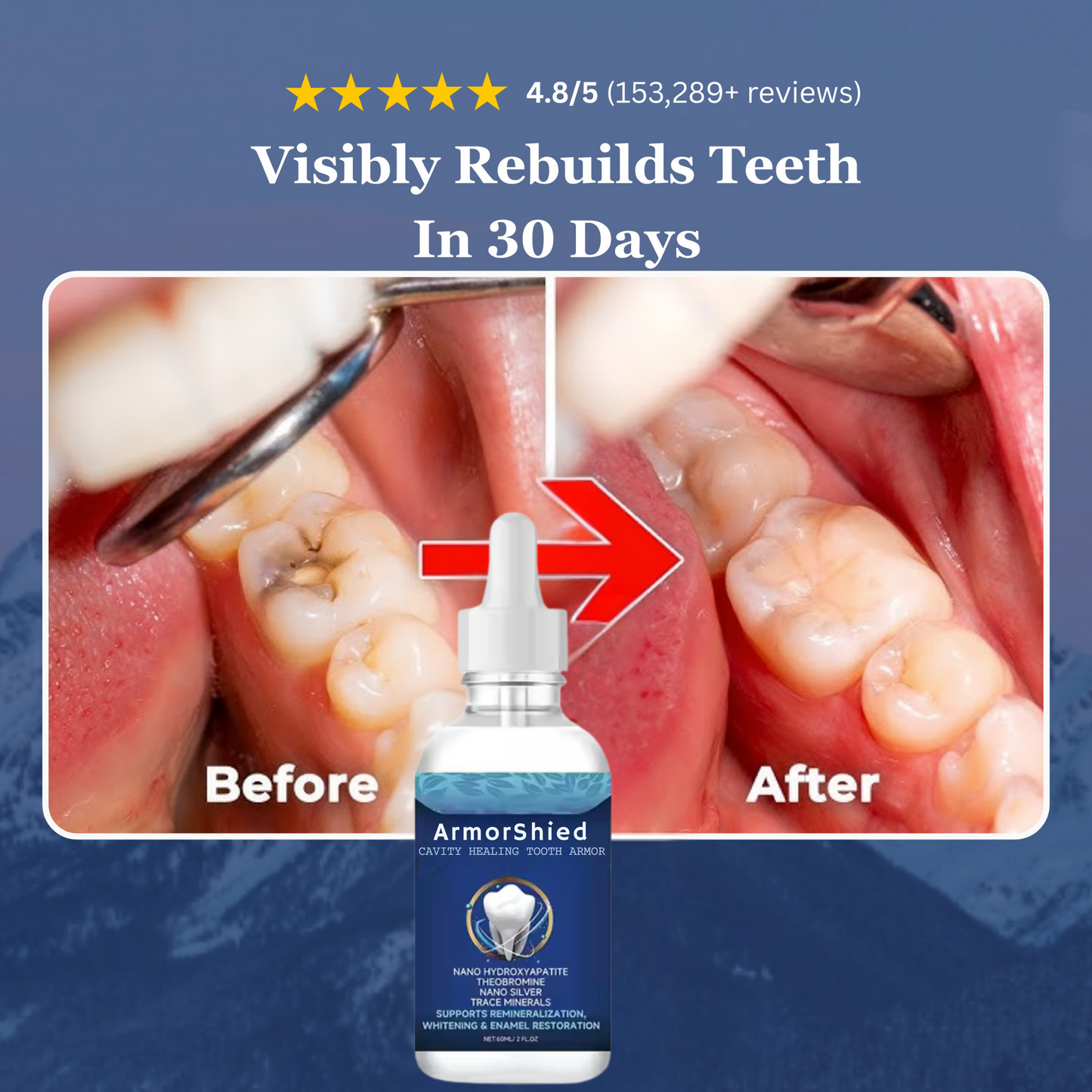 ArmorShied Tooth Armor Liquid Drops
